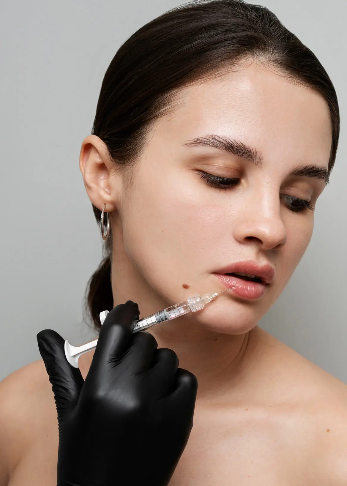 Filler – Hyaluronsäure für Volumen und Kontur